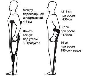 Конструкция костылей